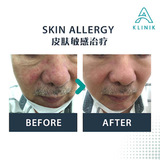 A Klinik (Jelutong) | Skin Dermatology 皮肤问题 | Acne Scar 痘疤｜ Pigmentation 黑斑｜Hair Loss 脱发 | Family Medicine | Health Screening