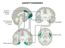 ANXIETY DISORDER TREATMENT NYC