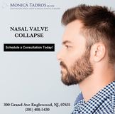 Nasal Valve Collapse