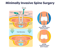 BACK AND SPINE SURGERY | SPINAL RECONSTRUCTION